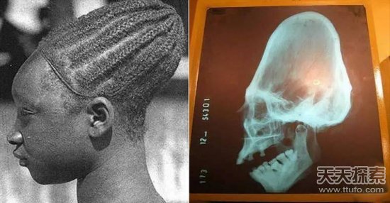 婴儿几个月长头骨 00300050692_d0cb7ccf.jpg